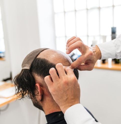 Man getting a hairpiece fitted professionally.